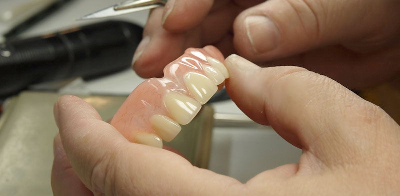 Denture Repair