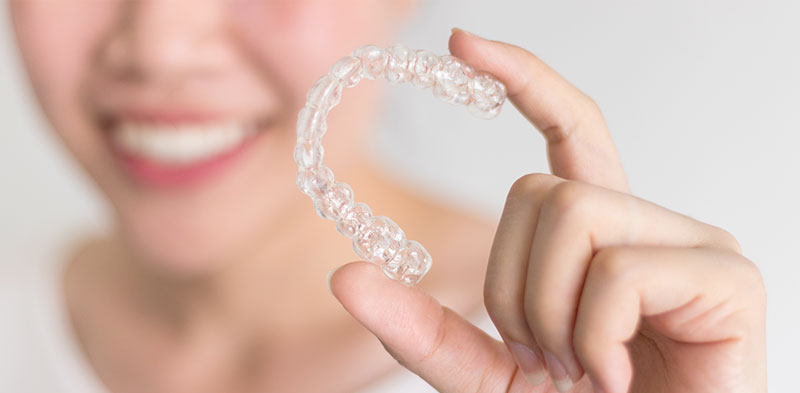 Costs of Invisalign braces