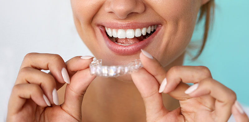 Cost for Invisalign braces for Adults
